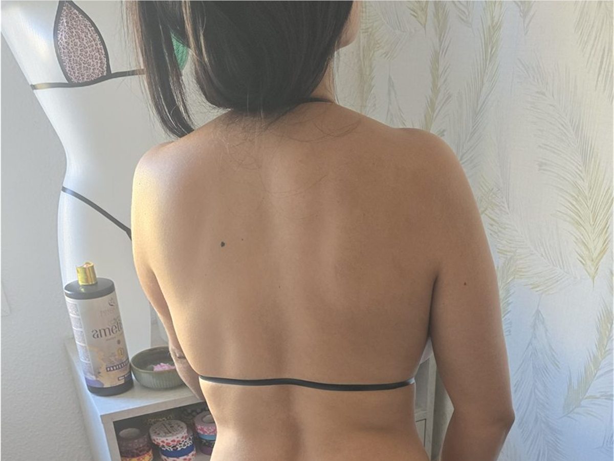 Detalle de la espalda durante el bronceado brasileño
